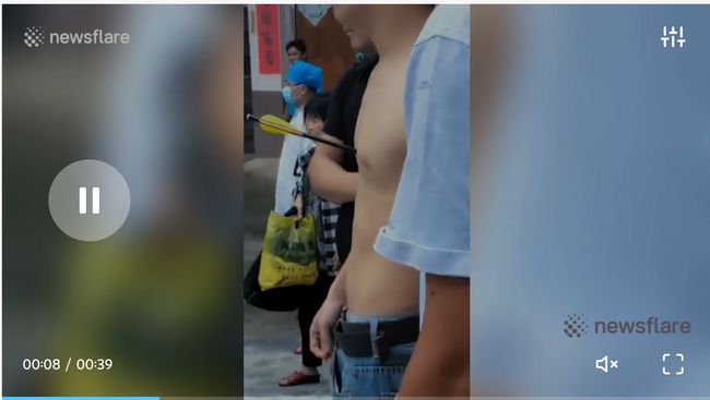 【閲覧注意】悲惨なボウガン事件が中国でも発生! 矢が刺さった人間はこうなる… 引き抜いたら死にそうな姿に衝撃=中国の画像3