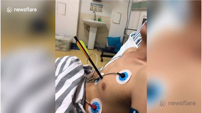 【閲覧注意】悲惨なボウガン事件が中国でも発生! 矢が刺さった人間はこうなる… 引き抜いたら死にそうな姿に衝撃=中国の画像4