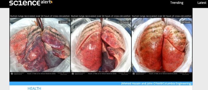 損傷した肺をブタにつないで修復する技術が爆誕! ハンパない効果を確認、肝臓・心臓・四肢再生にも応用へ!?(最新研究)の画像1