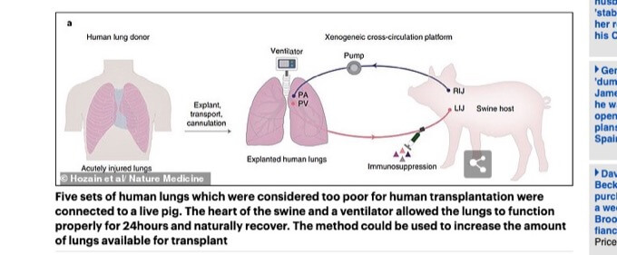 損傷した肺をブタにつないで修復する技術が爆誕! ハンパない効果を確認、肝臓・心臓・四肢再生にも応用へ!?(最新研究)の画像2
