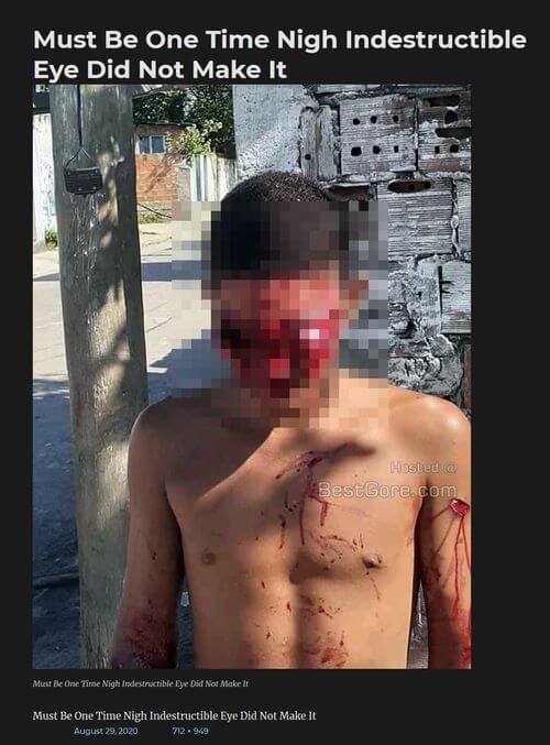 【閲覧注意】顔面に銃弾を浴びながらもサバイブした男! あらゆる要素がごっそり剥がれ落ち… 超戦慄の姿=ブラジルの画像1