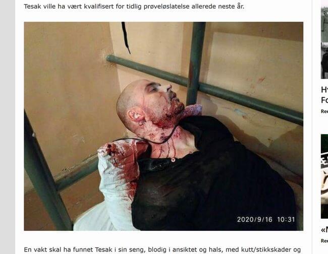 【閲覧注意】ロシアの超大物ネオナチ、マルツィンケビッチが刑務所でエグすぎる不審死! 血塗れの死体画像流出… 殺害疑惑も浮上!の画像6