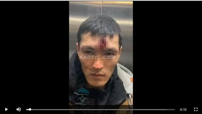 【閲覧注意】額のド真ん中を撃たれた男が平然と帰宅!! 治安部隊との衝突で負傷したデモ参加者の姿がヤバすぎる=キルギスの画像1