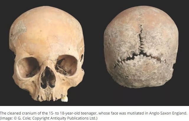 鼻・唇・頭皮を削がれて殺された少女の頭蓋骨が発見される! 1100年前の恐怖と苦しみの死ヤバすぎる全貌と理由とは?の画像1