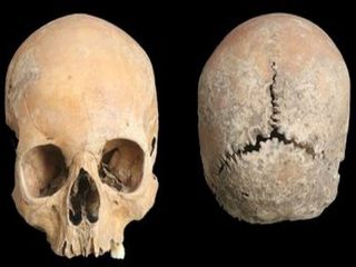 鼻・唇・頭皮を“削がれて”殺された少女の頭蓋骨”が発見される！ 1100年前の“恐怖と苦しみの死”ヤバすぎる全貌と理由とは？