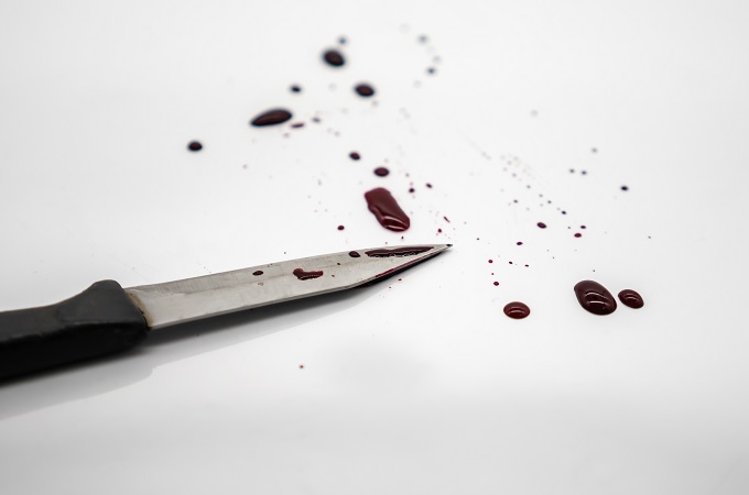 妻がレイプされる現場に居合わせた男が、犯人のペニスを切断! レイプ魔より重罪になる可能性も…!の画像2