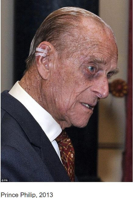 セレブに共通する目のアザは ブラックアイクラブ の儀式だった レプティリアンと融合した 手術痕 か ｰトカナ 2ページ目