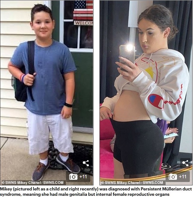 ペニスをもって生まれたトランスジェンダー少女がまさかの妊娠! 性自認の混乱と苦悩を乗り越え強い母になる=米の画像2