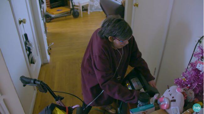 頭に2本のツノと3本目の腕、眼球一つ、全身変形…! 結合双生児の痕跡が残った女性の前向き人生に感動!=米の画像3
