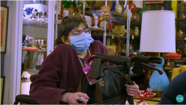 頭に2本のツノと3本目の腕、眼球一つ、全身変形…! 結合双生児の痕跡が残った女性の前向き人生に感動!=米の画像5