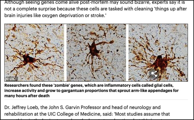 人間の死後に活性化し腕のようなものを伸ばす「ゾンビDNA」が発見される!! 心停止しても遺伝子レベルでは生きていた!(最新研究)の画像2