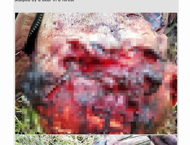 【超・閲覧注意】クマに襲撃された男の恐ろしすぎる最期!! 剥ぎ取られた頭皮が散乱、クマは人間の頭部から攻撃する!?=ロシアの画像2