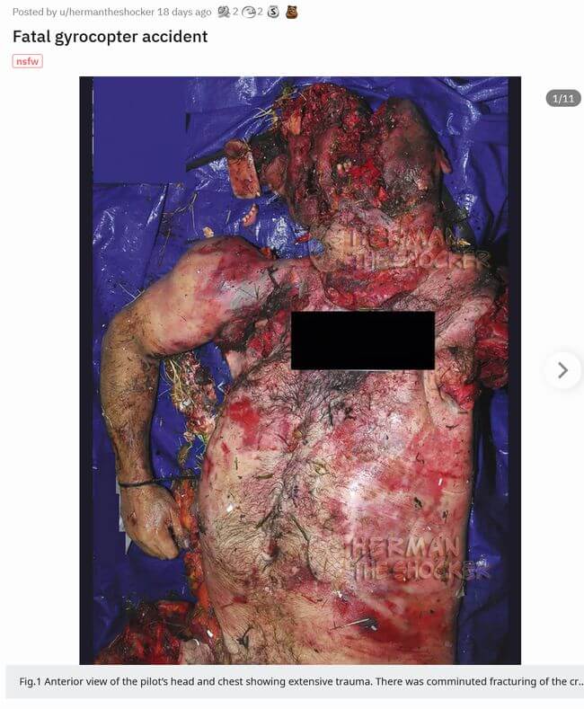 【超・閲覧注意】ヘリコプター墜落事故の犠牲者が悲惨すぎる! 全身バキバキ、骨が粉砕、内臓ぶちまけ… 衝撃の強さを物語る肉塊の画像2