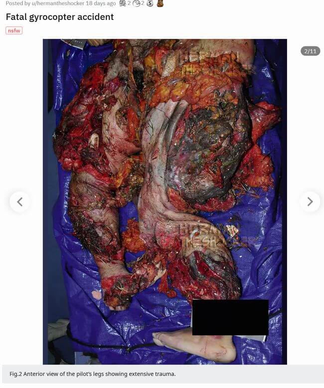 【超・閲覧注意】ヘリコプター墜落事故の犠牲者が悲惨すぎる! 全身バキバキ、骨が粉砕、内臓ぶちまけ… 衝撃の強さを物語る肉塊の画像3