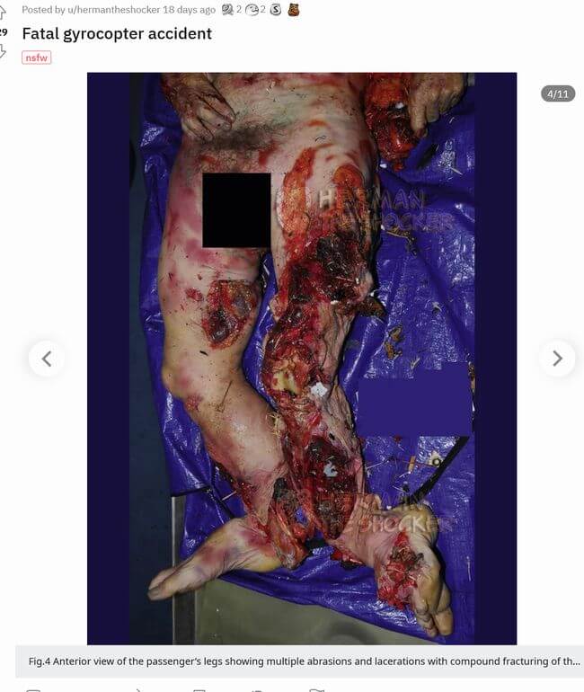 【超・閲覧注意】ヘリコプター墜落事故の犠牲者が悲惨すぎる! 全身バキバキ、骨が粉砕、内臓ぶちまけ… 衝撃の強さを物語る肉塊の画像5