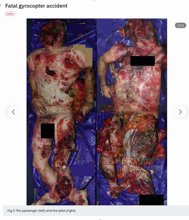 【超・閲覧注意】ヘリコプター墜落事故の犠牲者が悲惨すぎる! 全身バキバキ、骨が粉砕、内臓ぶちまけ… 衝撃の強さを物語る肉塊の画像6