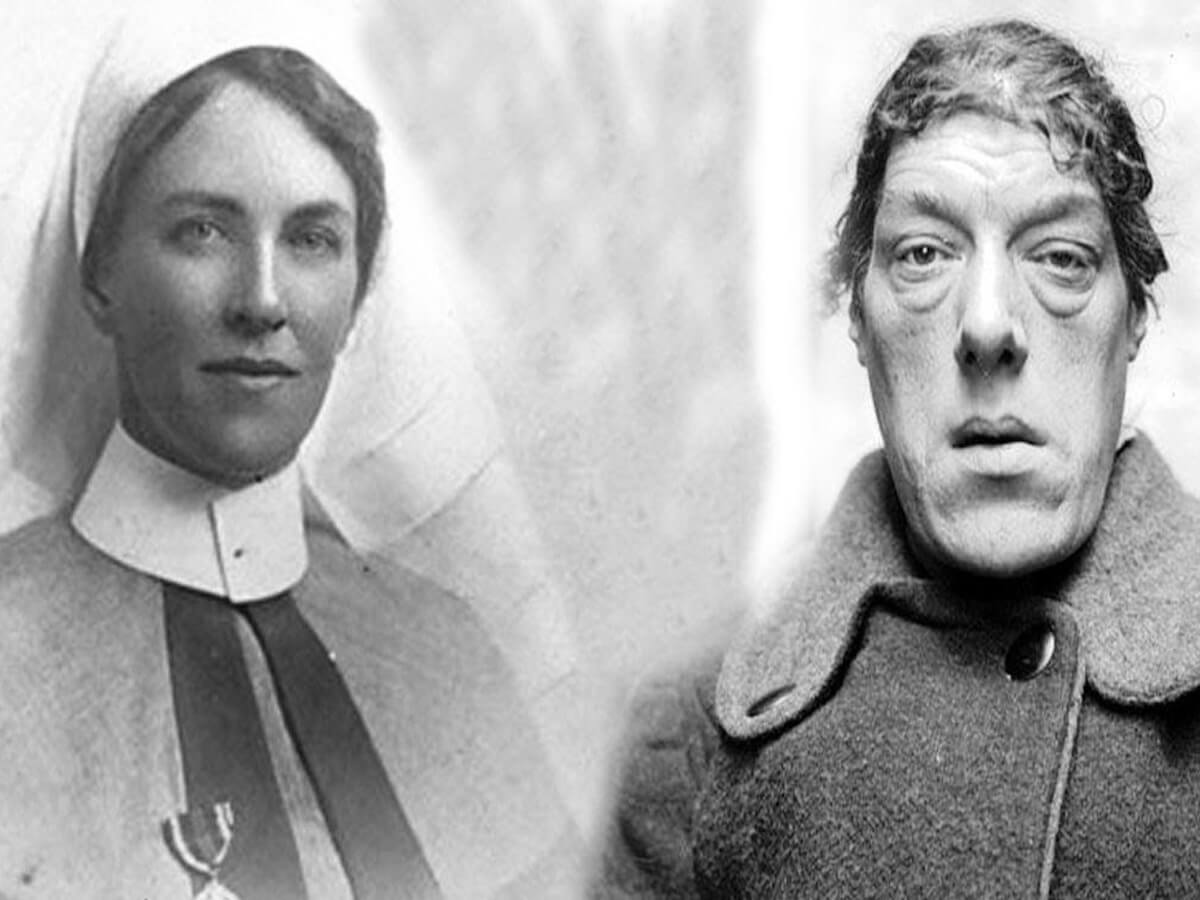 世界一醜い女性 の哀しくも力強い生き様 崩れゆく顔 愚弄嘲笑 見世物小屋 想像を絶する辛苦に立ち向かい 全ては子供のため