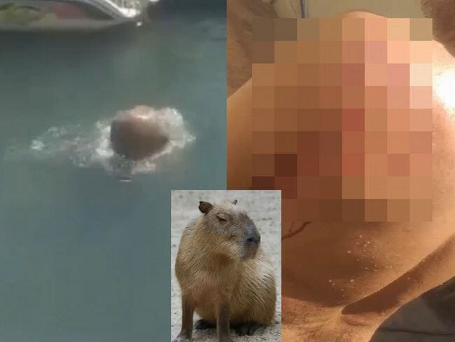 【閲覧注意】ブチ切れたカピバラに襲われたらこうなる!! 体に穴を空けられ… 可愛さに隠れた戦闘力=ブラジルの画像1