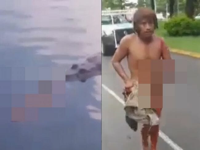 【閲覧注意】ワニに「腕を食い千切られ」茫然自失の男が悲惨すぎる! メキシコで相次ぐ洗濯中の襲撃の画像1
