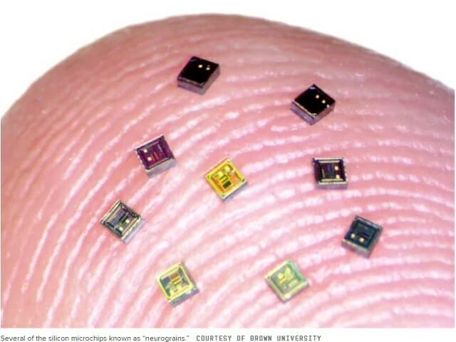 脳に770個のチップを埋め込みまくる研究が進行中! 頭がラジオ化、信号の外部送信も可能に!の画像1