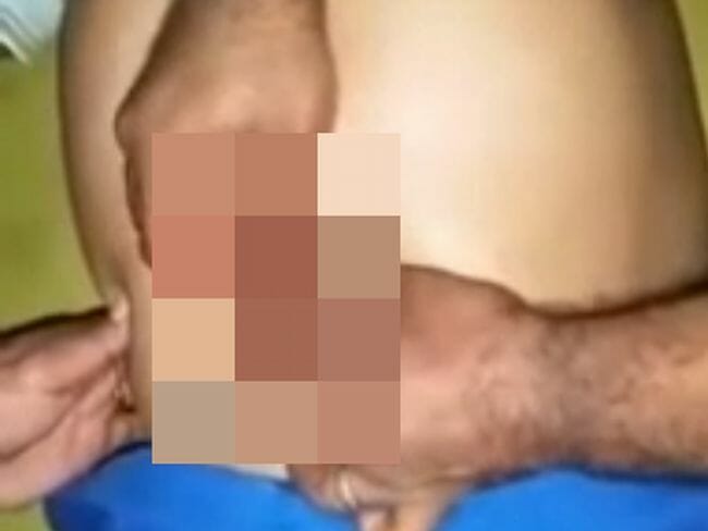 【閲覧注意】ヘソから引き抜かれるネズミの死骸…! 謎すぎる手術映像流出、背景に貧困か?の画像1