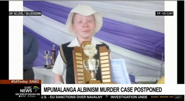 【閲覧注意】金運アップの儀式で使うためアルビノの子供を惨殺して解体! 呪術医が裁判で無罪を主張=南アの画像2