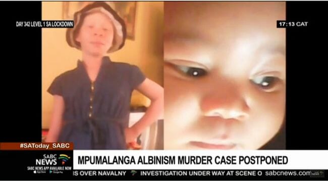 【閲覧注意】金運アップの儀式で使うためアルビノの子供を惨殺して解体! 呪術医が裁判で無罪を主張=南アの画像3