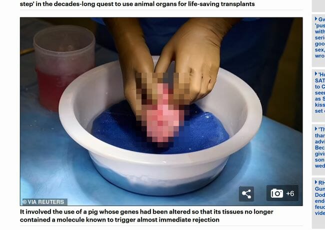 【手術映像】世界初、ブタの腎臓をヒトに移植成功、公開された映像が本気でヤバい!=米の画像4