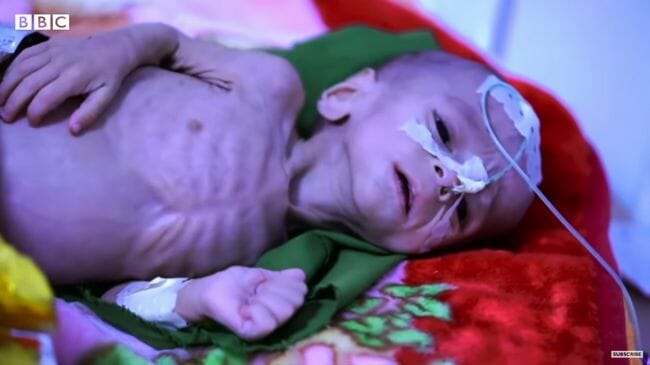 飢餓に苦しむアフガニスタンの子供たち！ 100万人が骨と皮に… タリバン支配で人道危機が深刻化の画像1