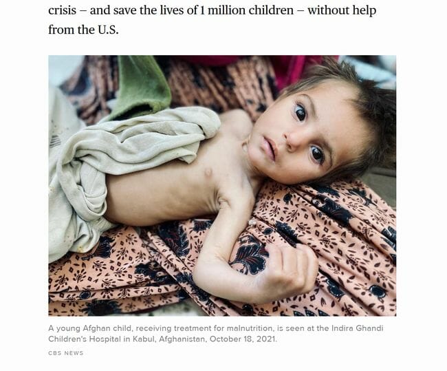 飢餓に苦しむアフガニスタンの子供たち! 100万人が骨と皮に… タリバン支配で人道危機が深刻化の画像3