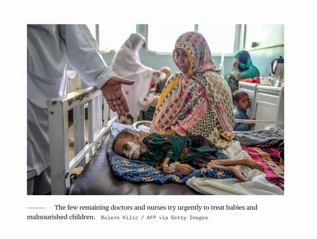 飢餓に苦しむアフガニスタンの子供たち! 100万人が骨と皮に… タリバン支配で人道危機が深刻化の画像5