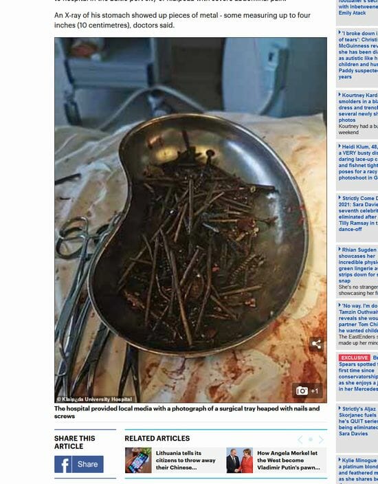 「810万円分の胃袋」持つ女を病院で開腹した結果…! 異食症患者が抱える深刻な問題とは!?の画像2