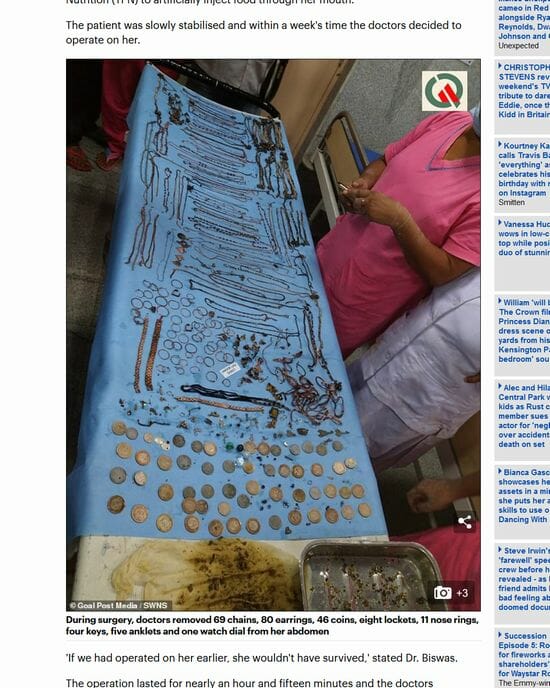 「810万円分の胃袋」持つ女を病院で開腹した結果…! 異食症患者が抱える深刻な問題とは!?の画像3