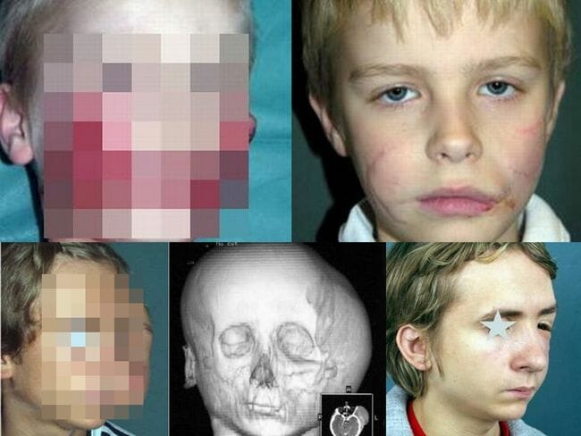 形成外科は顔をどこまで修復できるのか？ 学術誌掲載「顔面再建手術」の驚異的事例5選の画像1