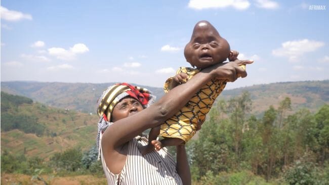 「エイリアン」と呼ばれて罵られる赤ん坊の苦難！ 見捨てられた母子を救えるか？＝ルワンダの画像6