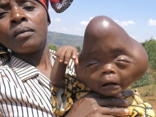 「エイリアン」と呼ばれて罵られる赤ん坊の苦難！ 見捨てられた母子を救えるか？＝ルワンダ