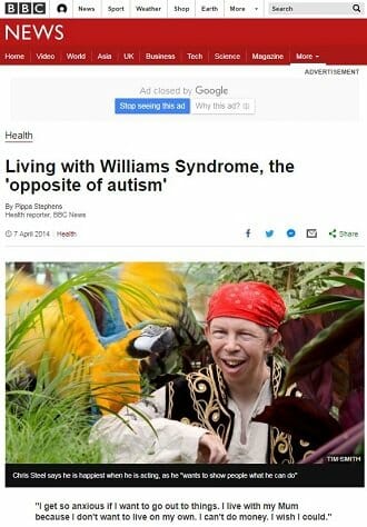 出会う人すべてを愛しまくる奇病「ウィリアムズ症候群」! DNAが人懐こい犬と類似、人類の最新進化系か!?の画像2