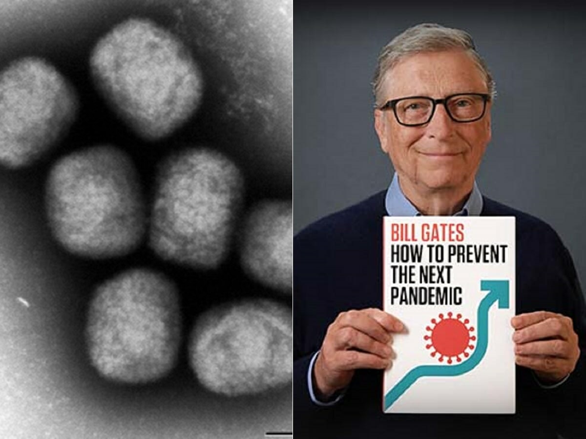 ビル・ゲイツはサル痘の感染拡大を予見していた？ 事前シミュレーションの恐ろしい内容が判明 - TOCANA