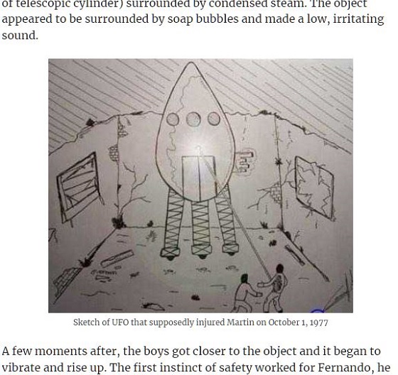 UFOビームが直撃した少年に起きた絶望的異変とは!? 脳外科手術を14回… 超壮絶な健康被害の全貌の画像2