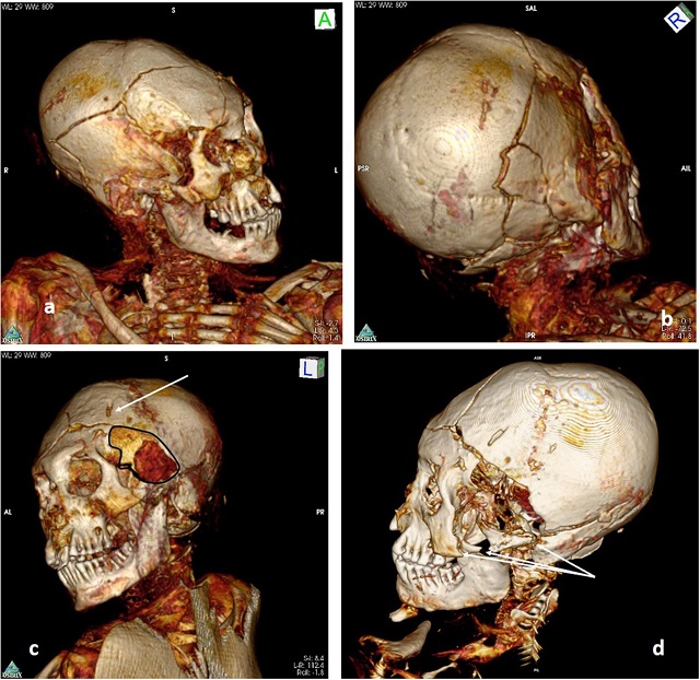 1100年前の南米のミイラ、残虐の限りを尽くして殺されていた! 最新3DCTスキャンで判明した怖すぎる最期の画像2