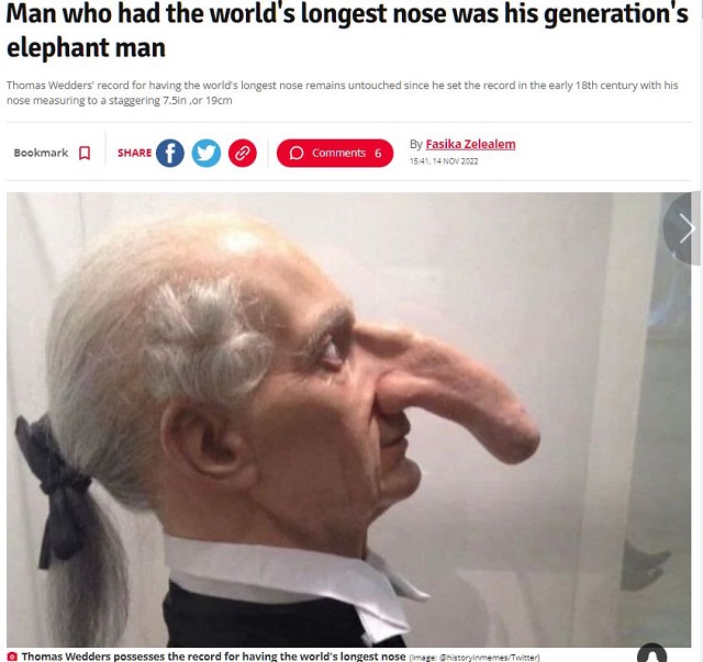 世界一長い19センチの鼻を持っていた男! ギネスブックにも登録されたエレファントマンとは?の画像1