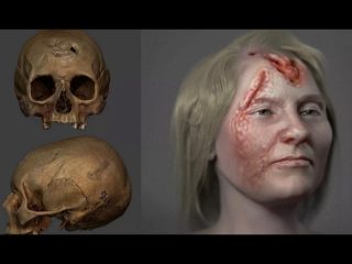 梅毒で死亡した500年前の女性の顔を復元… 顔がただれ、頭蓋骨に穴