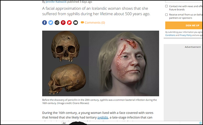 梅毒で死亡した500年前の女性の顔を復元… 顔がただれ、頭蓋骨に穴の画像1