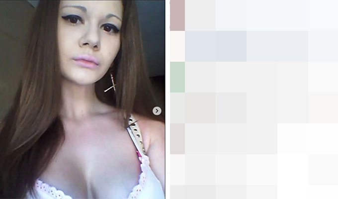 世界最大の「タラコ唇」!? 唇へのヒアルロン酸注射を30回繰り返した女性が完全に別人化!の画像1