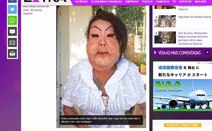 闇の美容整形で美女の顔面が崩壊… ブラジルの扇風機おばさんの悲痛な叫び 「私はいじめられ続ける!」の画像1