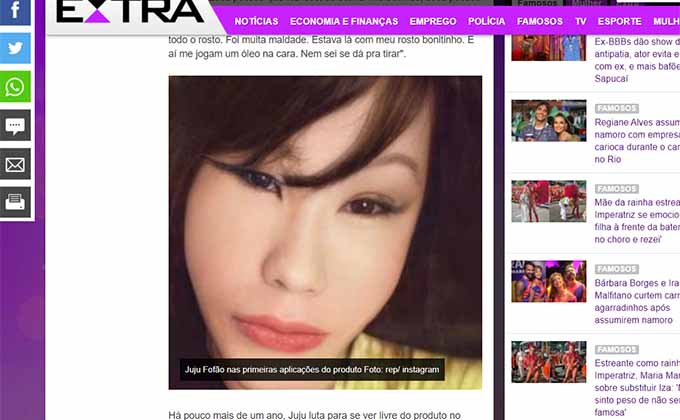 闇の美容整形で美女の顔面が崩壊… ブラジルの扇風機おばさんの悲痛な叫び 「私はいじめられ続ける!」の画像2