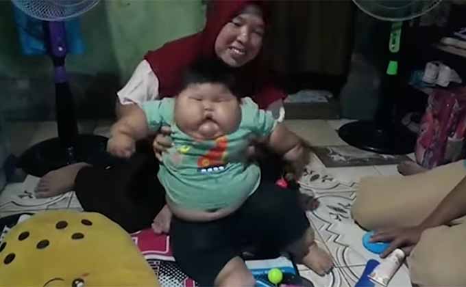 XXXLのオムツを履く27kgの赤ちゃん! 生後16カ月で8歳児と同体重、一体なにが…?の画像2