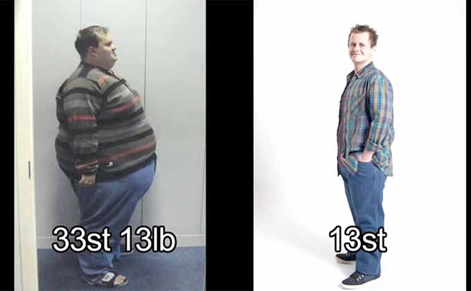 人間ドーナツと呼ばれた男性が17カ月で190kgの減量に成功！ 「歯腐る」「バケツトイレ」…驚愕生活とは？の画像2
