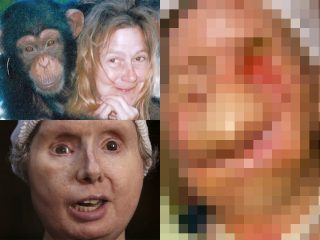 チンパンジーに顔面を破壊された女性の痛ましい姿… 野生動物をペットにすることのリスク