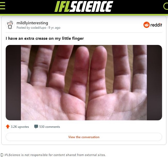 小指に「余分な関節」が存在する人がいる? 発生確率1%以下の超レアケースの画像1